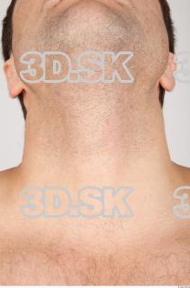 Neck texture of Koloman 0001